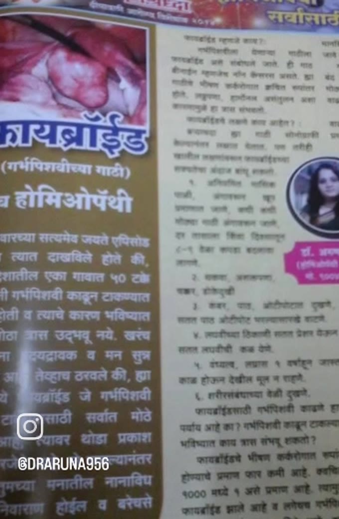 Janshraddha Diwali health special on fibroids and homeopathy